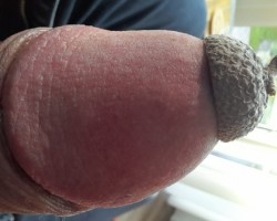 String