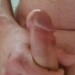 Lid