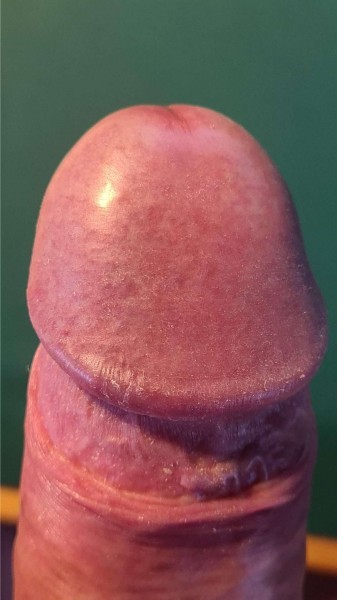 <p>Even van dichtbij..</p>