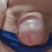 Lid